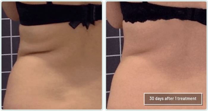 Love Handles